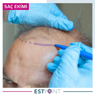 Slider image (7) Estpoint